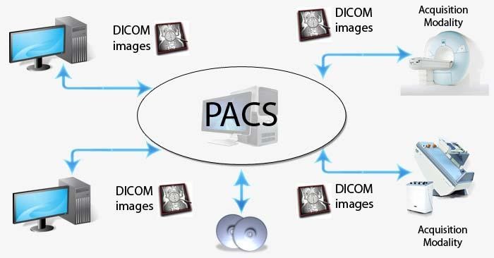 Different Types of PACS Systems?