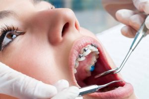orthodontist in las vegas