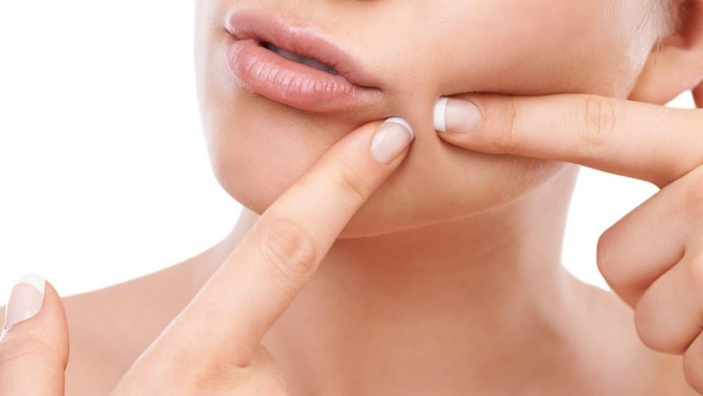 Common Myths About Pimples