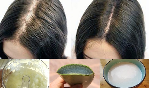 home remedies to stop hair fall