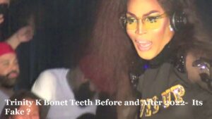 Trinity K Bonet Teeth Before and After 2022- Its Fake ?