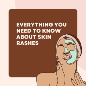 Everything You Need to Know About Skin Rashes