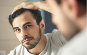 μεταμοσχευση μαλλιων