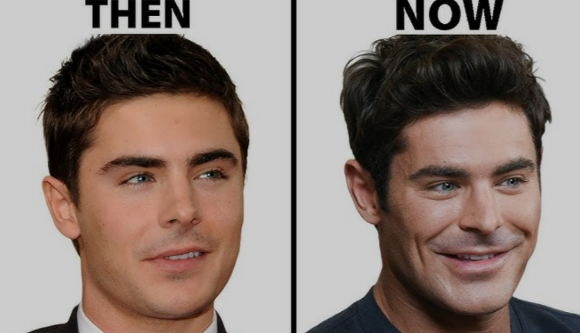 Zac Efron’s Face